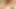 婦人科医の診察は急速に悪化しています!