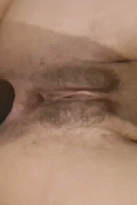 Dilation