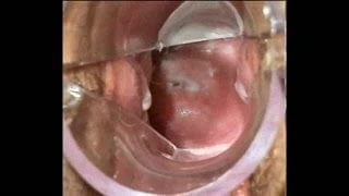 Speculum Cum