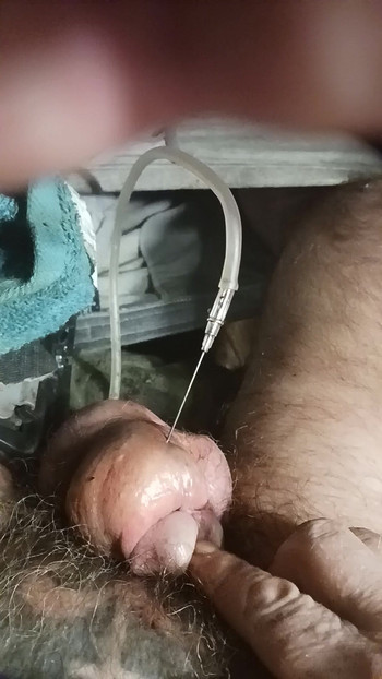 Tiny Cock Inflated & Catheterised