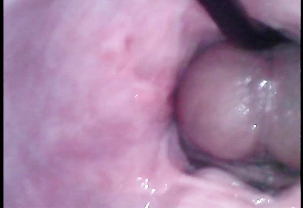 Mani muncrat dalam di dalam memek - cam internal creampie di memek saku.
