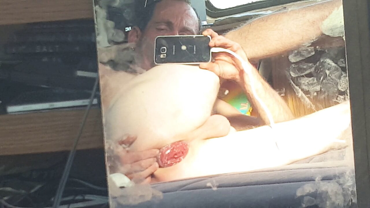 Prolapsing my ass