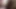 - [First lesbian] The initial thrilling feeling is unpleasant again! When I a girl, it blossomed!