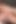 Siyah çoraplı iri güzel orta yaşlı seksi kadın ameliya şişman amını siktiriyor