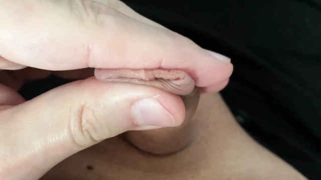 small forskin penis