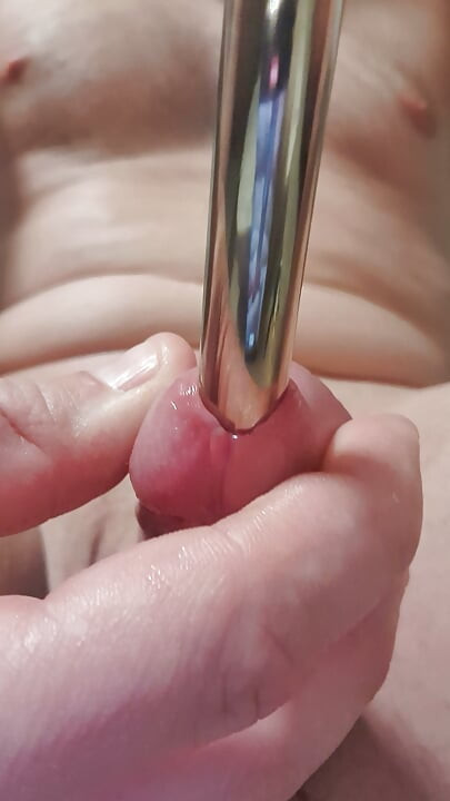 Extremely stretched hole after dilator play