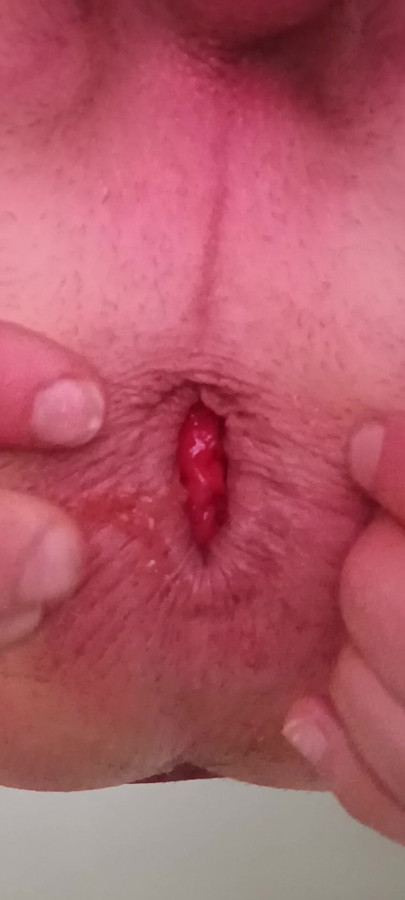Welcoming hole, tasty prolapse