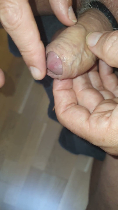 Needles in testicles and glans | Clip 1