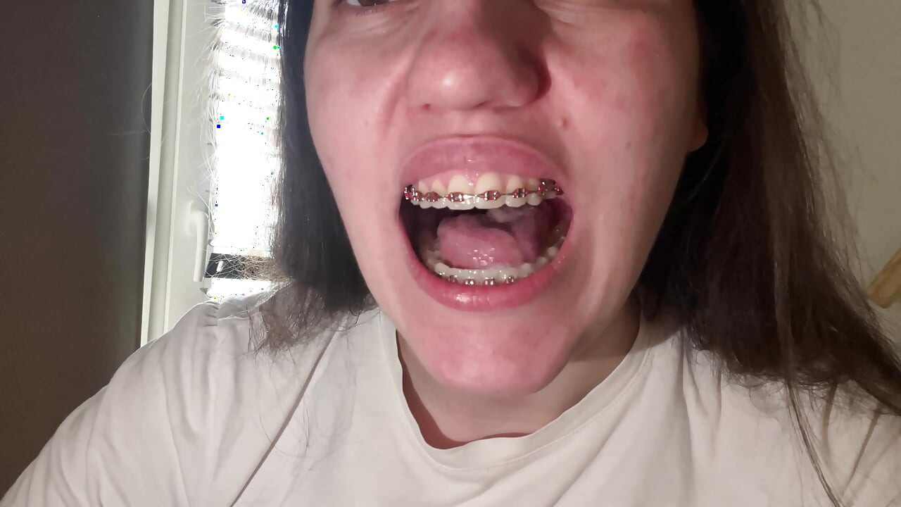 لعق تقويم أسنانك بلسانك