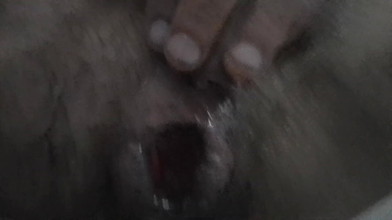 Piss on fisted prolapse