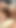 Kinda hasta kız seks oyuncak olarak yapay penis ile başka bir lezbiyen esmer tarafından çaresini alır | Klip 3
