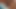 Anal masturbation