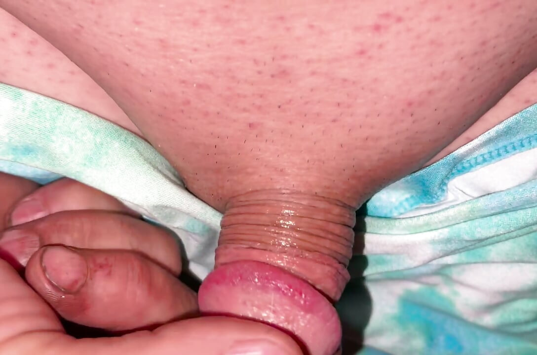 Playing with my 1 inch micro penis