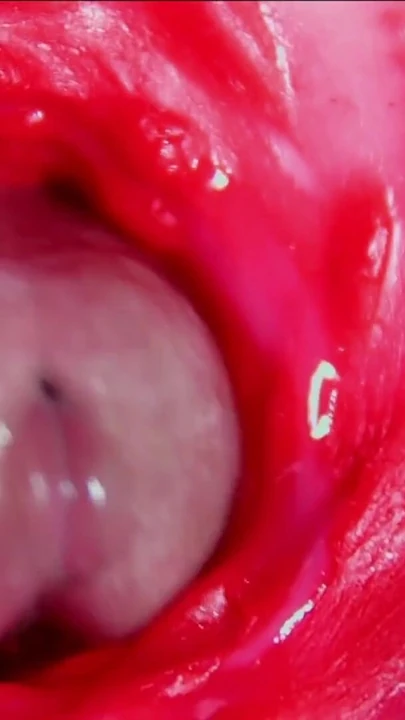 Epic moment from "Juicy beautiful pussy squelches inside ASMR close-up inside the anus"