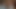 AUTSCH, DAS ERSTE MAL ANAL