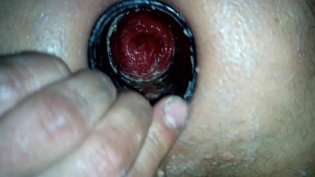 Anal insertion i6