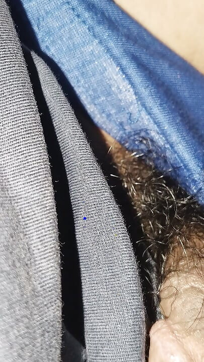Acne on my penis I want to clean it up