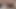 Cum drip from anal