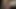 変態角質アジア人みだら064