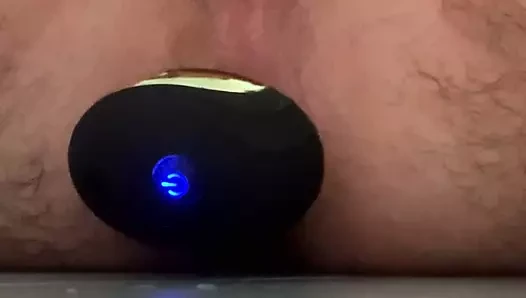 anal