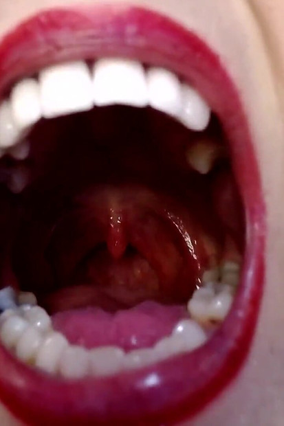 Big Wide Inside Both Girls Mouths