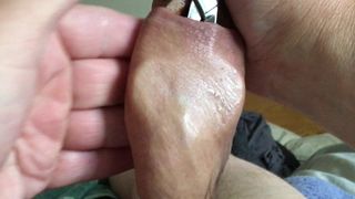 Sunday foreskin - 6 of 9 - spoon and scissors