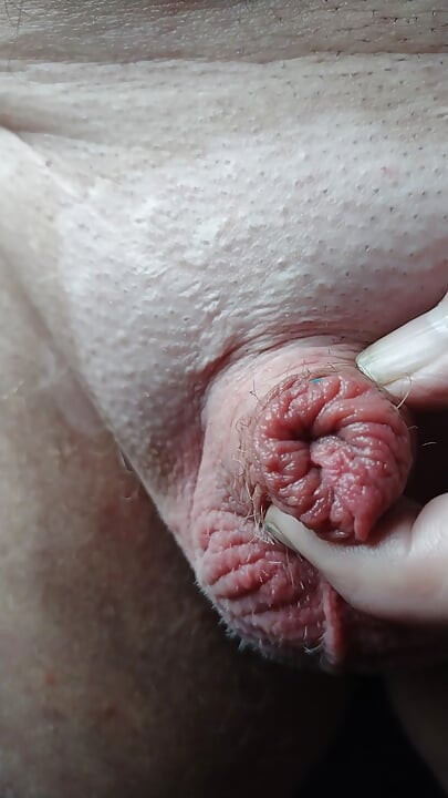 春の最初のイラクサ!