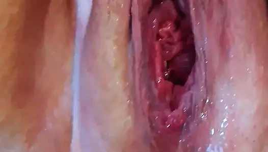 Masturbation Mit Spritzen)