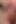 Natural showering and quick squirting