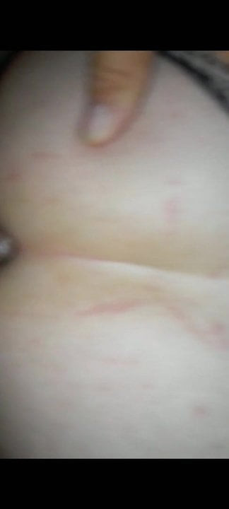 Anal 21