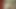 Ein Flotter Stich (Diamant Video)