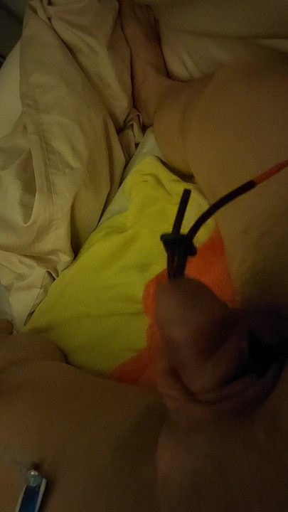 E uyaran elektro stimülasyon