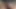 Cum frontal view of my foreskkn