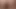 Anal