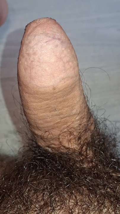 Kontol berbuluku