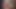 Sunshine foreskin - 5 of 8