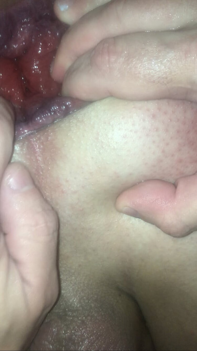 让脱垂