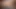 Light Brown Skin Complexion Girl Lay Naked Legs Pussy Open