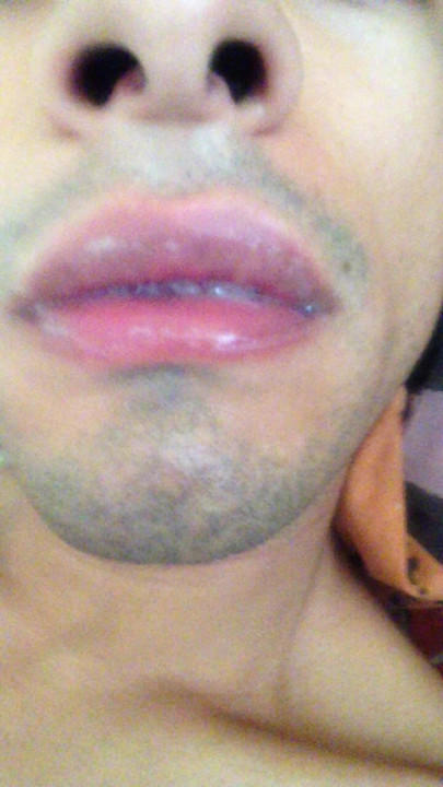 Swallowing straight loads