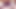 Huge Belly Bulge under my Ribs from Anal Balloon!