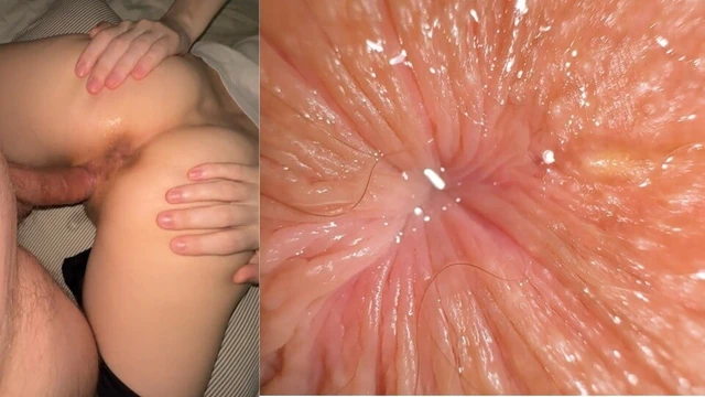 Flies do not sit down on my butthole because it’s lucked by cuckolds