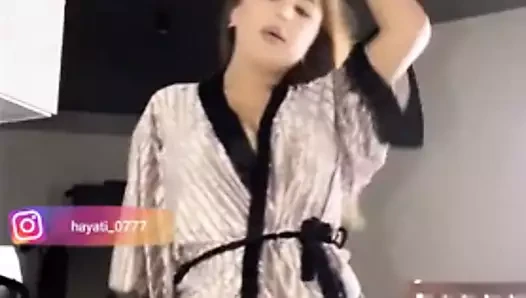 162514935
