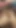 Boyfriend slapped girlfriend's big ass Girlfriend was screaming BF put a silicone condom and pushed it Hindi audio, xxx, porn. | Clip 2
