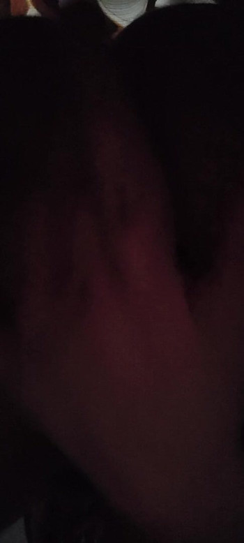 후장 피스팅