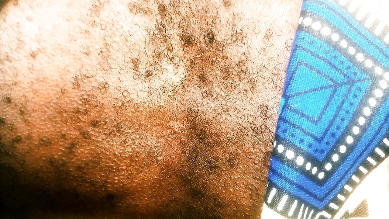 Massaging episode 109