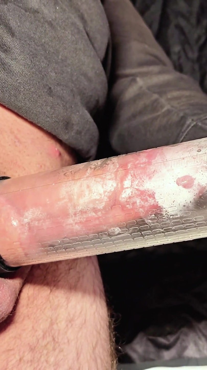 Key moment from "Huge multiple cum in a condom! I use a vacuum pump to help."