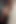Dirty Anal Squirting Redhead Interracial Anal Backshots Edited