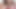 史上最高のBJ:ハッピーエンド保証