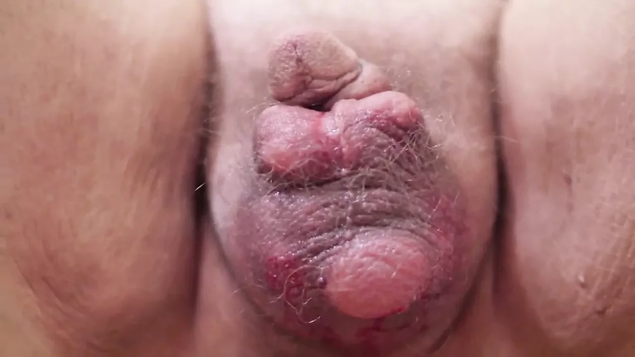 Scrotal saline inflation by Mistress doctor Valeria feat. Mistress T – CFNM, Medical, Hospital, BDSM HD Porn | xHamster