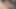büyük areolas piliç, çay poşeti ve anal
